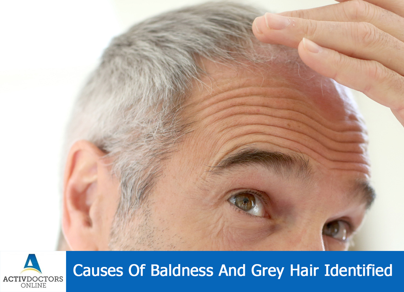 Causes Of Baldness And Grey Hair Identified