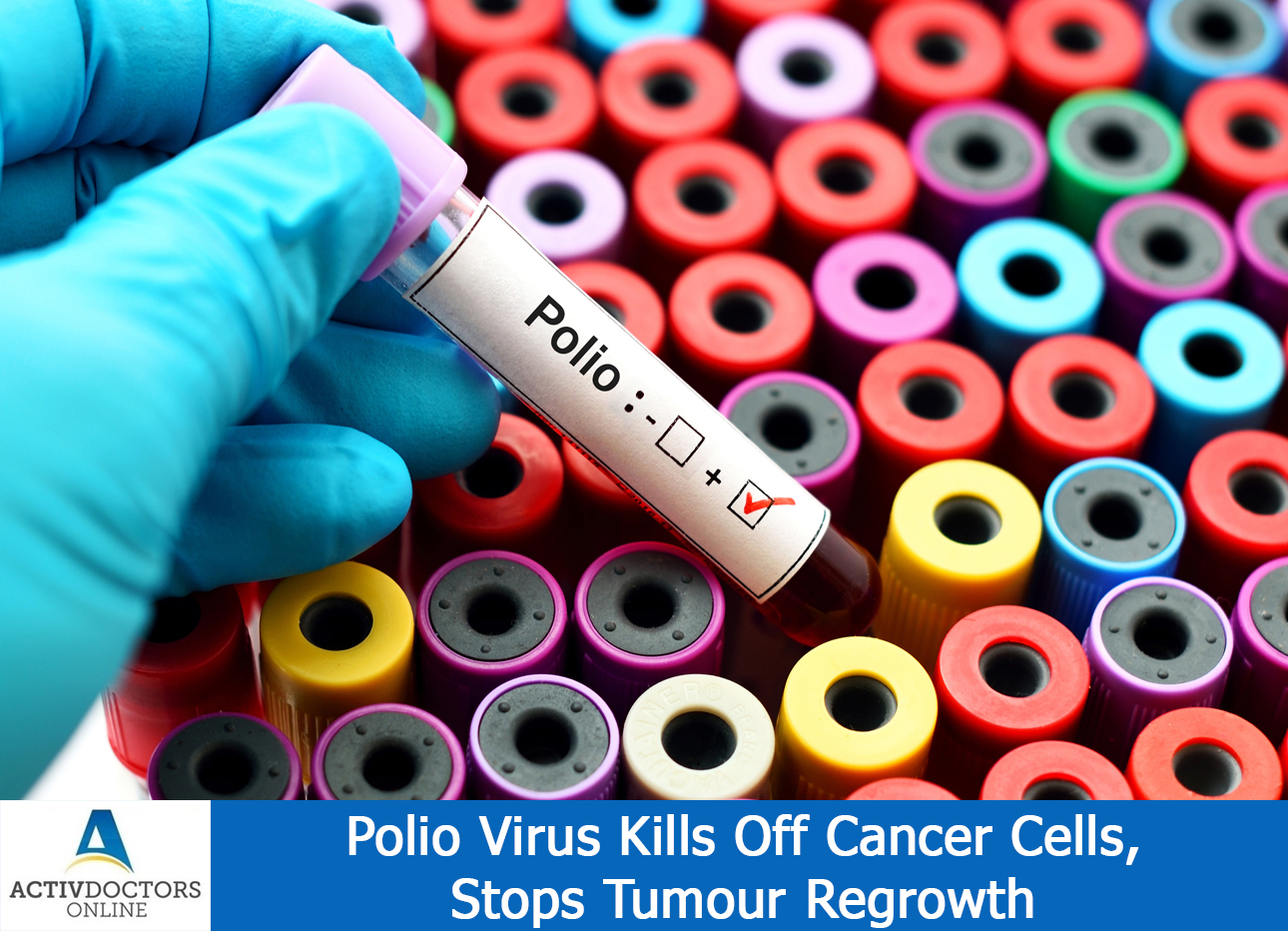 Polio Virus Kills Off Cancer Cells, Stops Tumour Regrowth