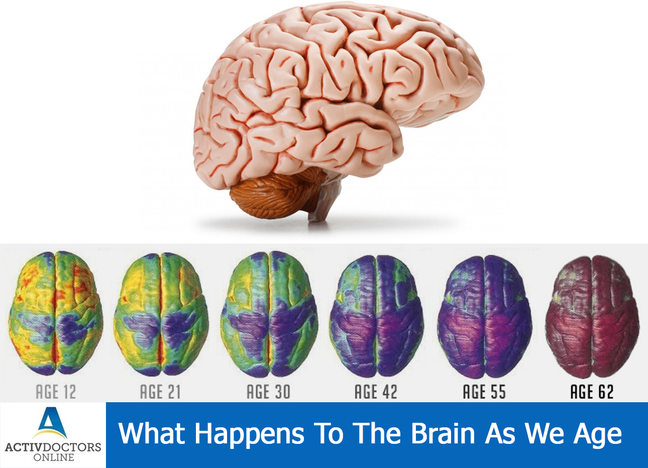 What Happens To The Brain As We Age