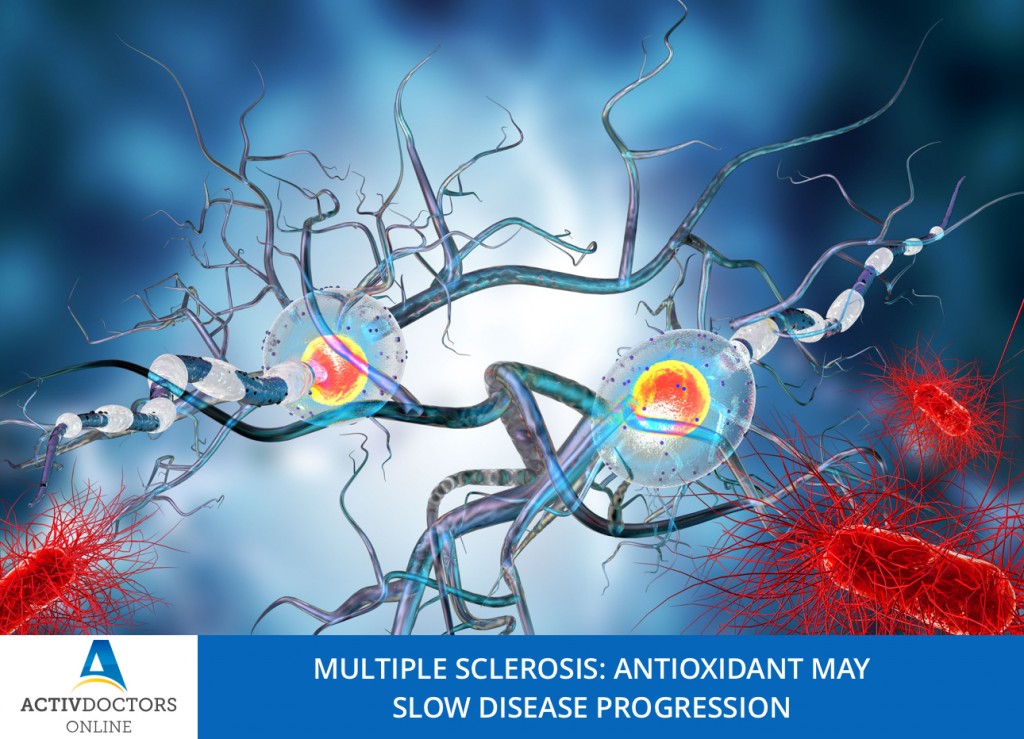 Multiple sclerosis